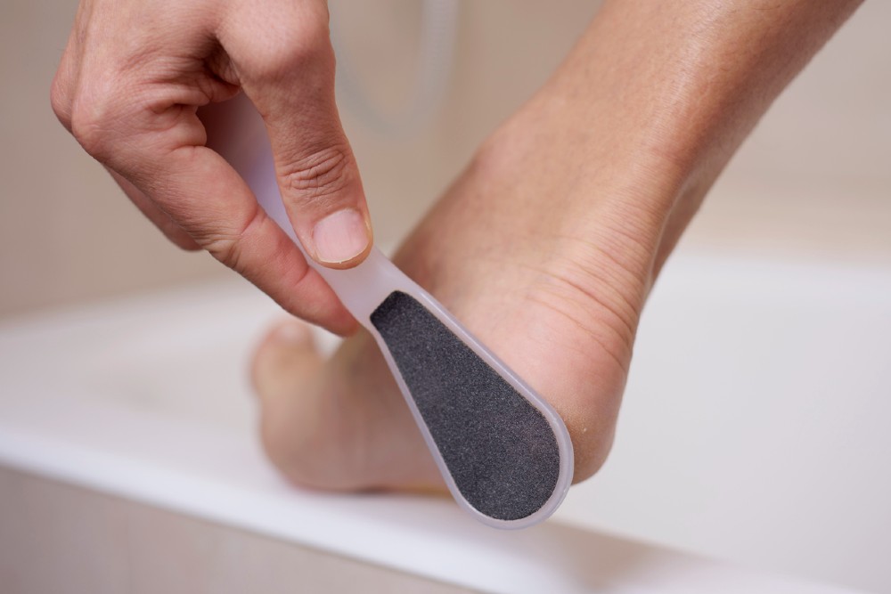 tool to remove calluses