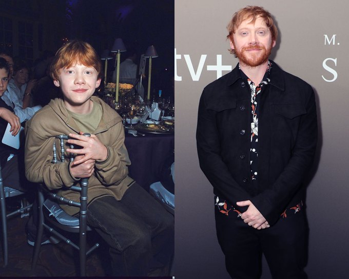 Rupert Grint: Then & Now