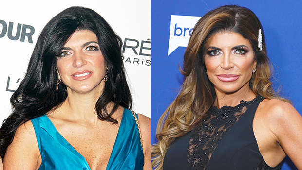 Teresa Giudice plastic surgery