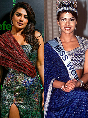 priyanka chopra surgery