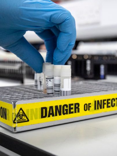 Human Metapneumovirus Outbreak in China: HMPV Symptoms & More